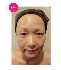 美肌リンパフェィシャル